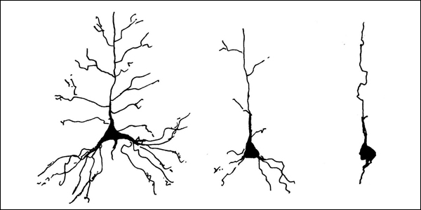 Parkinson