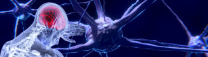Neurologie