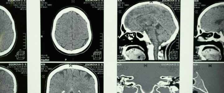 « Musique et cerveau, de la neuro-imagerie à la clinique »